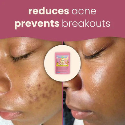 Turmeric & Kojic Acid Brightening Pads